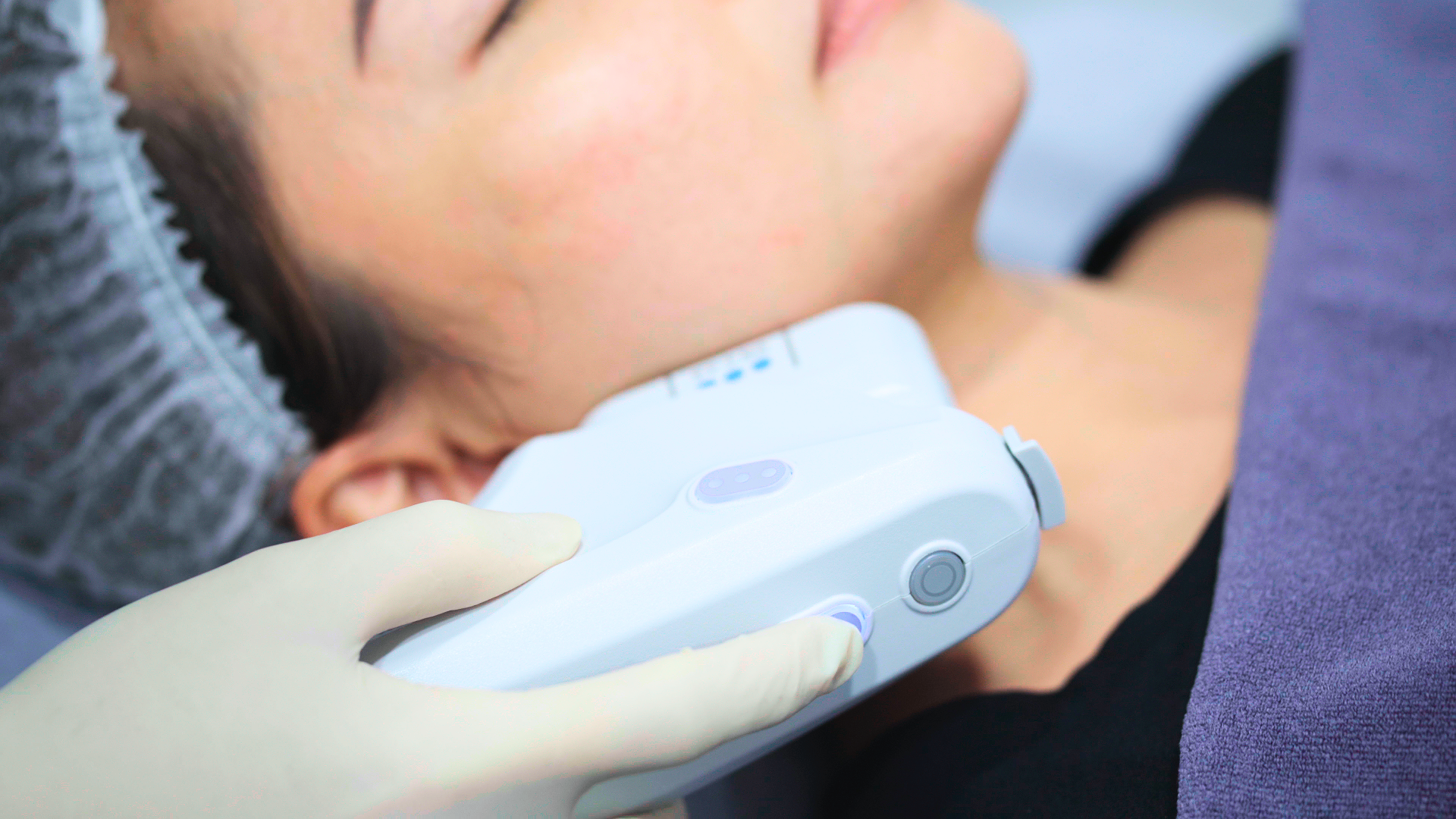 Ultherapy Prime Singapore